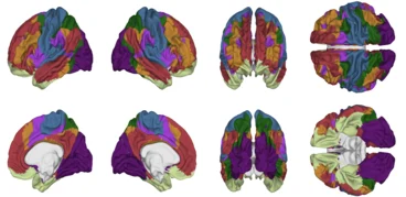 neuroimaging