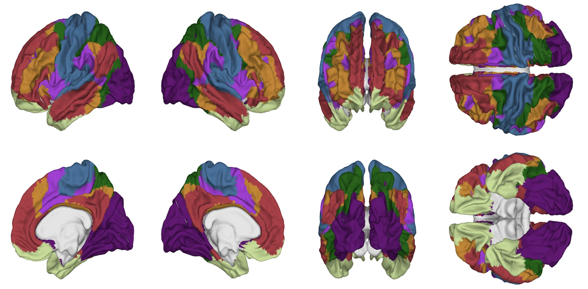 neuroimaging